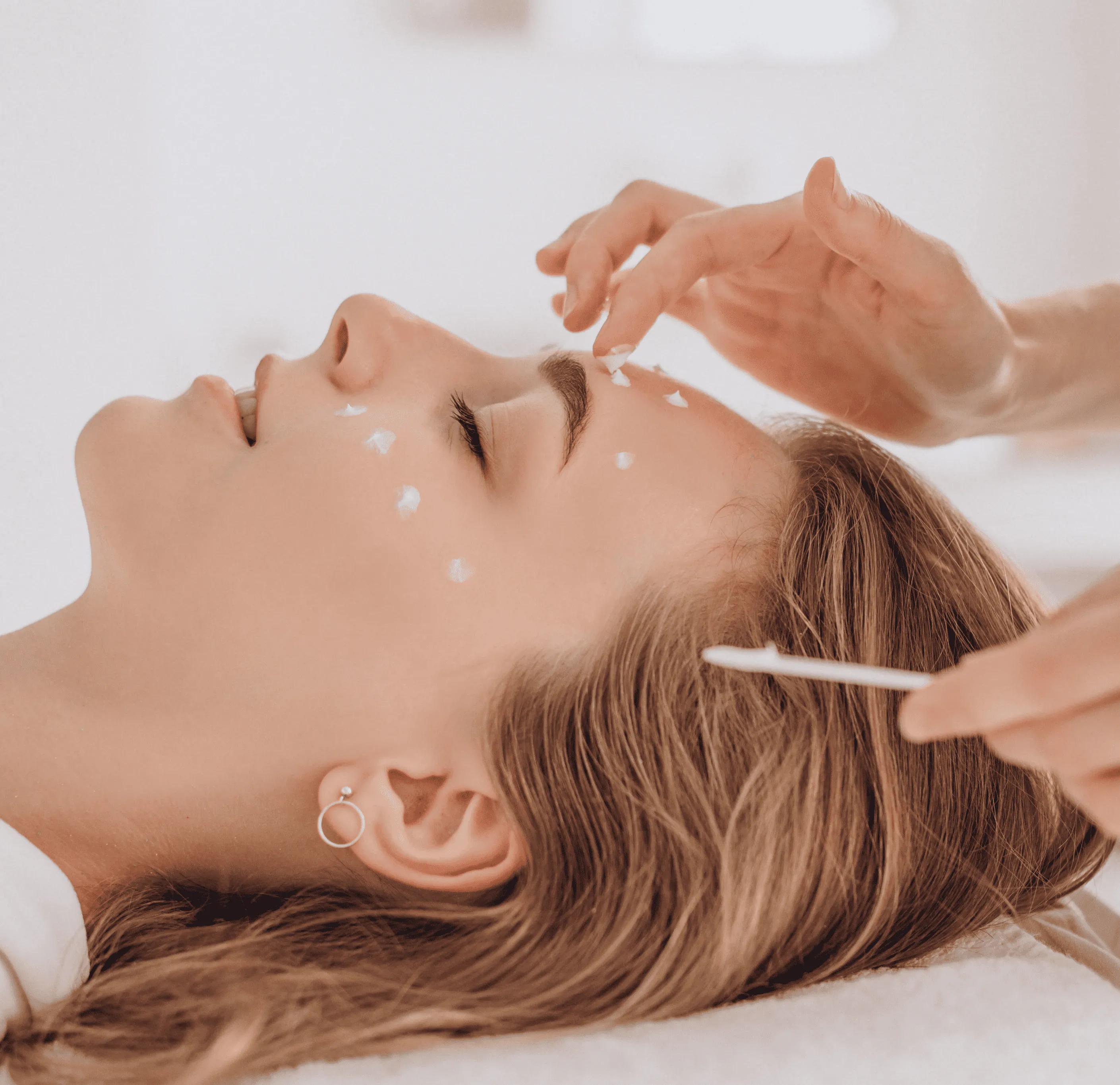 MEZOTERAPIA MIKROIGŁOWA — HolyHoli Therapy Lublin
